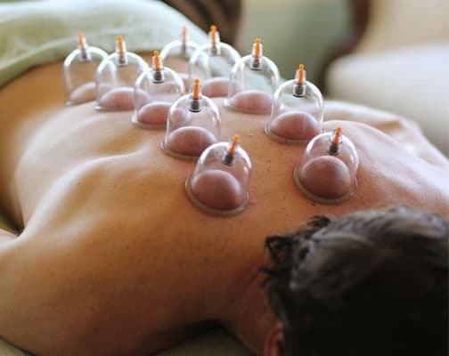 آموزش حجامت+بادکش+زالودرمانی