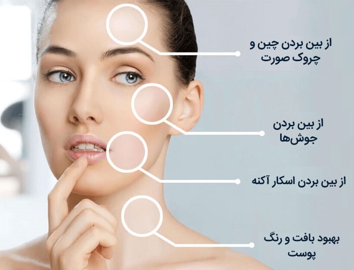 برگزاری دوره آموزشی مزوتراپی